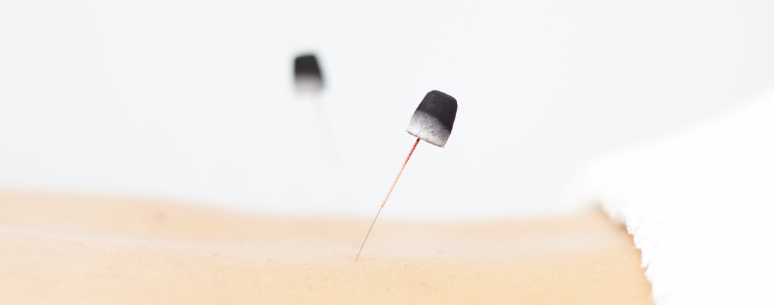 Ageing well with acupuncture and Chinese herbal medicine Ageing well with acupuncture and Chinese herbal medicine