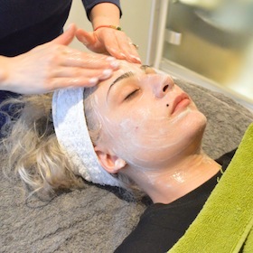 sh_beauty_yoannas skin peel 3