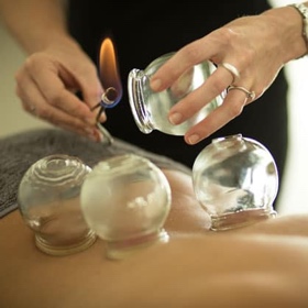 Cupping Cupping