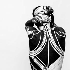 Fibromyalgia – The Facts As We Know Them