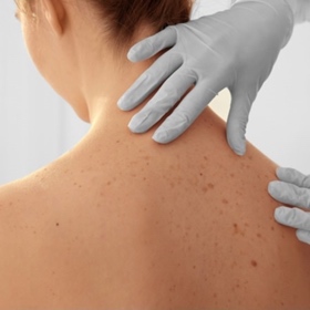 SH Health Skin exam
