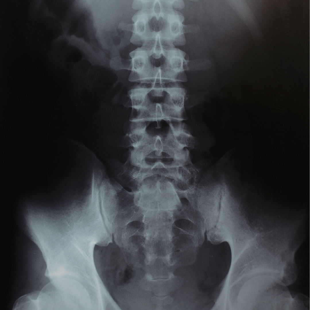 SG Health Xray