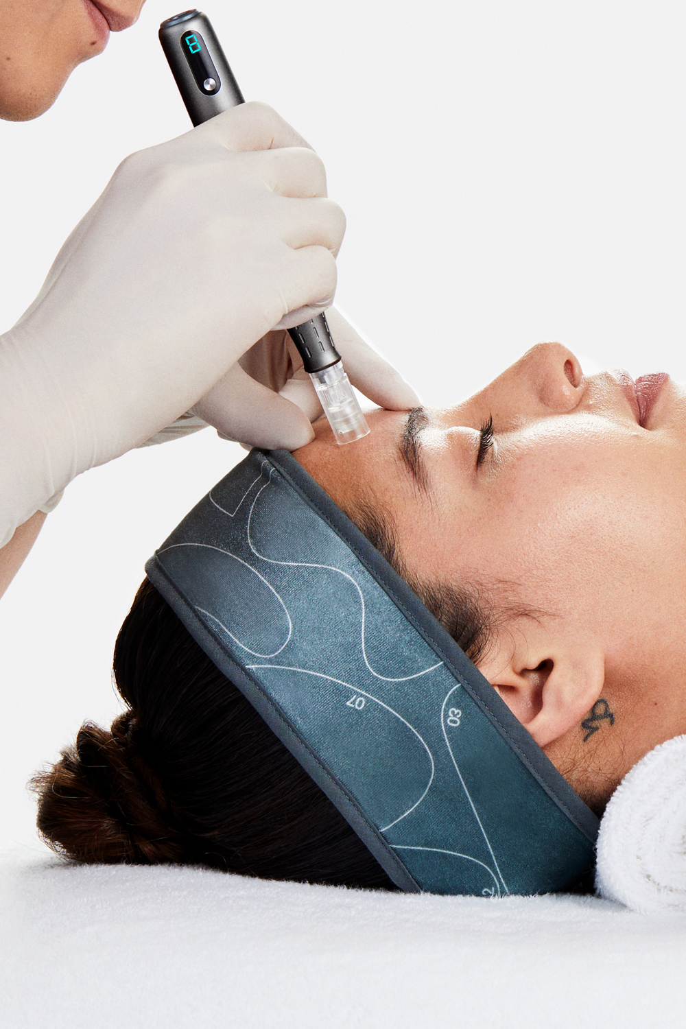 SG Beauty Micro needle facial SG Beauty Micro needle facial